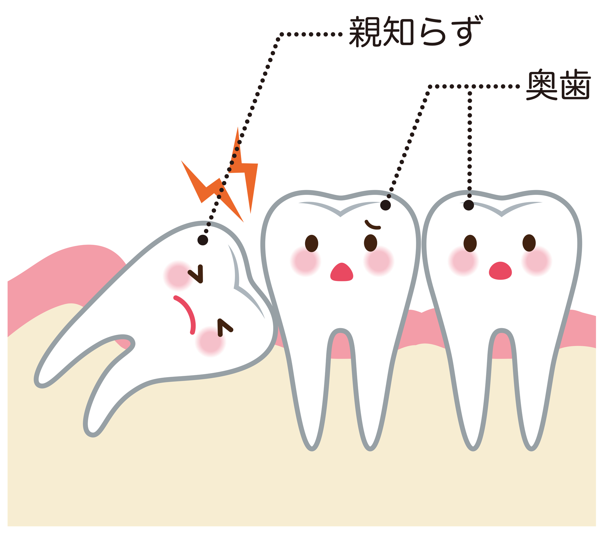 怖くない親知らずの抜歯